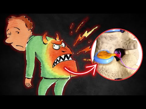 Видео: Колко е СТРАШНА Дисковата Херния?