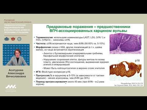 Видео: Предраковые поражения вульвы: новые подходы к классификации и диагностике