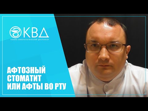 Видео: 1279  Афтозный стоматит или афты во рту