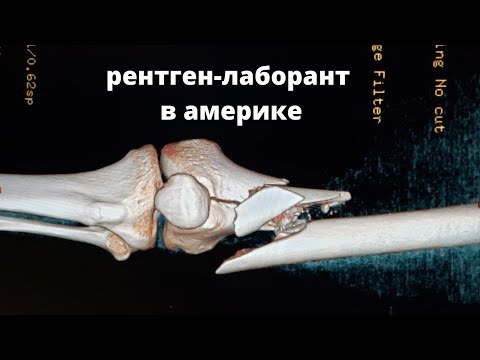 Видео: Учеба в Америке.  Профессия: Рентген-лаборант.