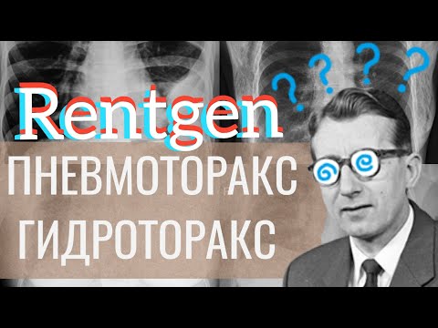 Видео: Рентген/x-ray: пневмоторакс, гидроторакс