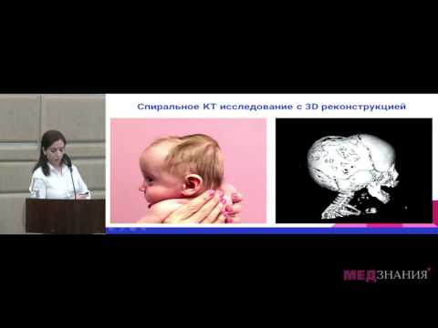 Видео: 12 А.М.Осипова