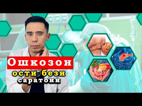 Видео: Ошқозон ости бези саратони хақида: статистика, сабалари, белгилари, даволаш усуллари❗️