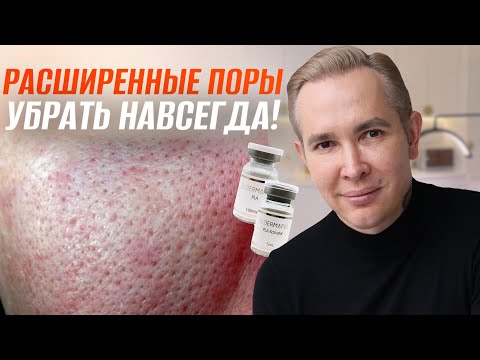 Видео: РАСШИРЕННЫЕ ПОРЫ Как избавиться в домашних условиях? САМЫЙ ДЕЙСТВЕННЫЙ СПОСОБ #mesomatrix