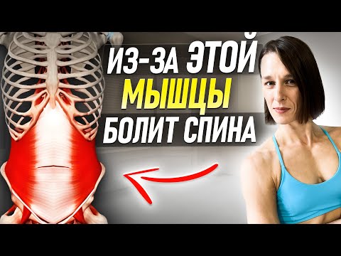 Видео: Из-за ЭТОЙ мышцы у 90% людей БОЛИТ ПОЯСНИЦА и ГИПЕРЛОРДОЗ | 4 упражнения, чтобы это исправить