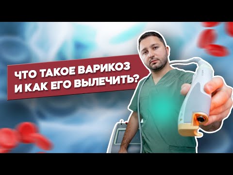 Видео: Как вылечить Варикоз ? Что такое ЭВЛК и КЛаКС (CLaCS) ?