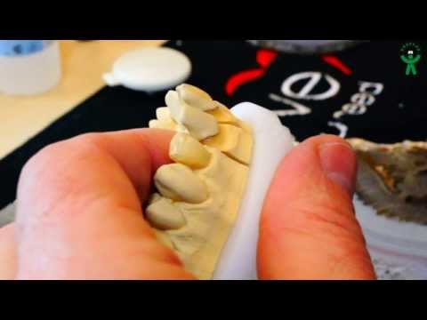 Видео: Duceram LOVE 3 этап