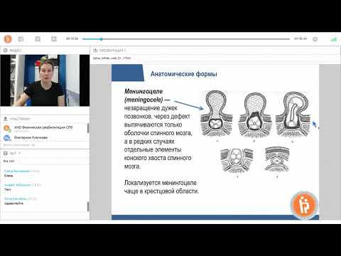 Видео: 1/10. Spina bifida: введение