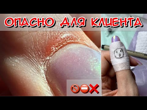 Видео: Опасно для клиента / Почему воспаление на кутикуле / Стерильный инструмент у мастера?