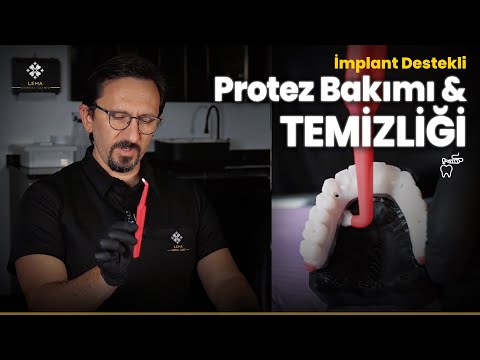 Видео: 🤍 Руководство по уходу за титановыми стержневыми имплантатами для здоровой улыбки