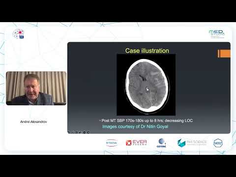Видео: Тромбэктомия - как избежать осложнений. Andrei Alexandrov