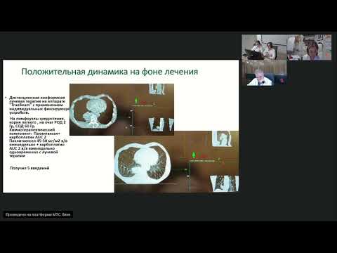 Видео: Рак легкого (вебинар 16 февраля 2024)