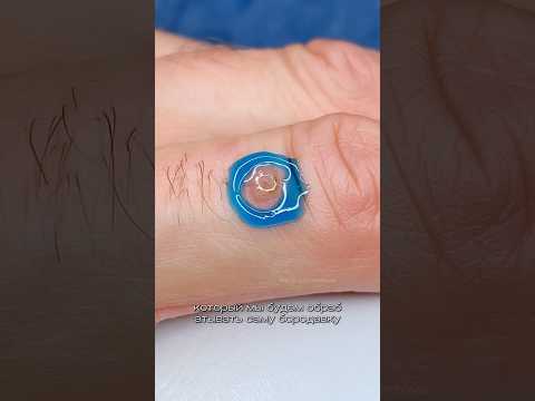 Видео: БОРОДАВКА обработка