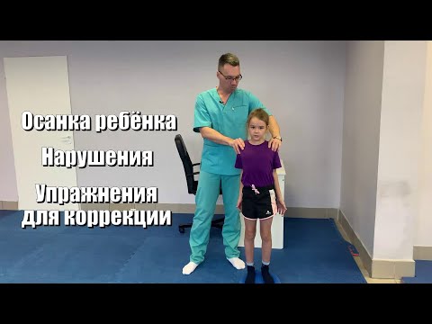 Видео: Осанка ребёнка. Существующие нарушения осанки и упражнения для её коррекции у детей.