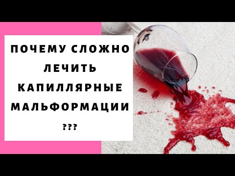 Видео: Капиллярная мальформация