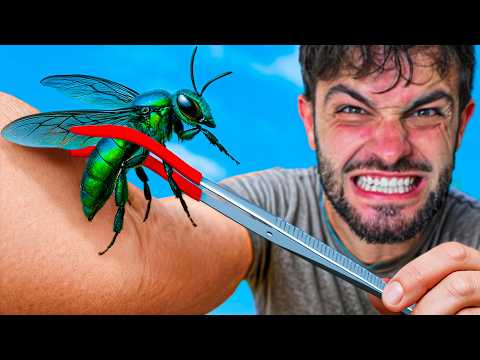 Видео: Ужалил Изумрудная Пчела – Худшие Укусы #16