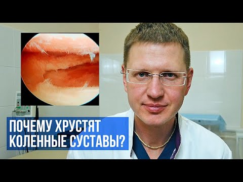 Видео: Почему хрустят коленные суставы? Как лечить?