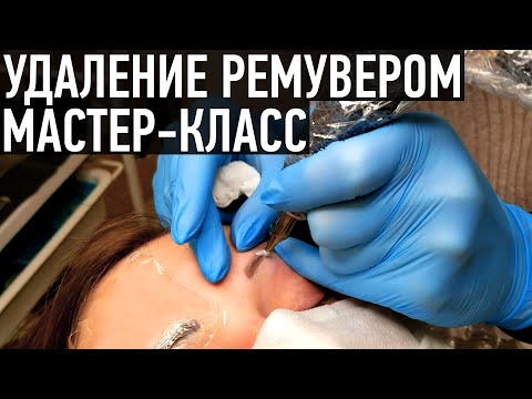 Видео: Удаление татуажа ремувером - мастер-класс от Ирины Ткачук