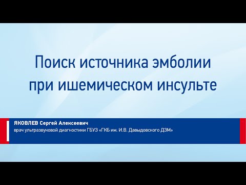 Видео: Яковлев С. А. Поиск источника эмболии при ишемическом инсульте