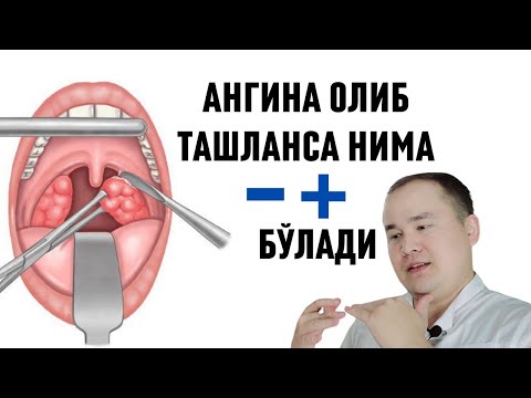 Видео: АНГИНАНИ ОЛДИРИБ ТАШЛАТСА НИМА ФОЙДА ВА ЗАРАРИ БЎЛАДИ \ У НЕГА КЕРАК \ ҚАЧОН МУМКИН ВА МУМКИН ЭМАС