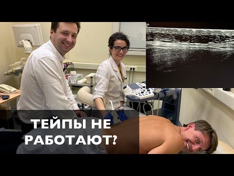 Видео: Как работает тейп? Эксперимент с кинезиотейпом и УЗИ часть 1