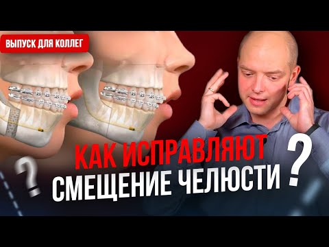Видео: Асимметрия лица. Как исправляют смещение челюсти? Выпуск для коллег