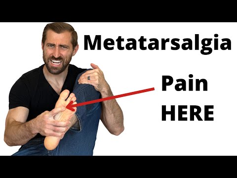 Видео: Диагностика и лечение метатарзалгии | Физиотерапия | Задайте вопрос FPF E:2