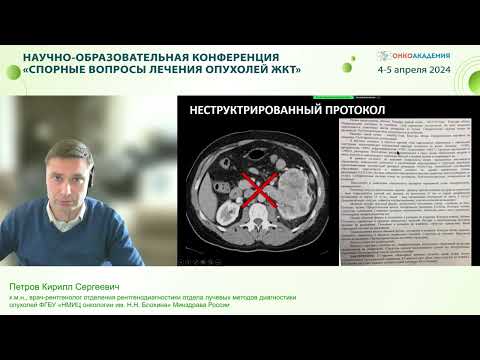 Видео: МРТ в диагностике рака прямой кишки: разбор наиболее типичных ошибок. Петров К.С.