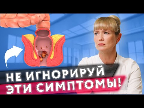 Видео: ВСЕ что нужно знать О ГЕМОРРОЕ || Симптомы, Причины и Лечение геморроя
