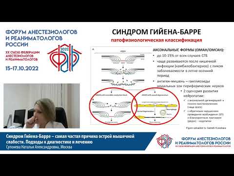 Видео: Синдром Гийена–Барре и острая мышечная слабость  Супонева Н.А.