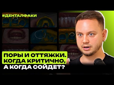Видео: #ДенталФаки - Поры и оттяжки при снятии оттисков