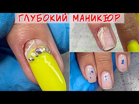 Видео: Дырка в ногте 😱 / Последствия глубокого маникюра