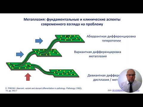 Видео: Метаплазия - путь к раку? 170 лет изучения