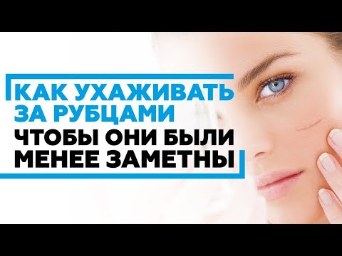 Видео: Как ухаживать за рубцами, чтобы они были менее заметны? #рубцы #шрамы