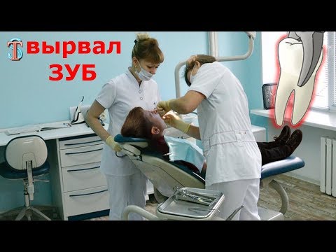 Видео: ВЫРВАЛ ЗУБ 😱!