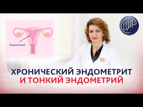 Видео: Хронический эндометрит, тонкий эндометрий с очагом обратного развития. Дементьева С.Н.