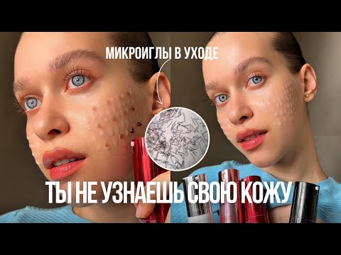 Видео: МОЙ УХОД ЗА КОЖЕЙ✨ по этапам | спикулы, микроиглы, как ухаживать за кожей