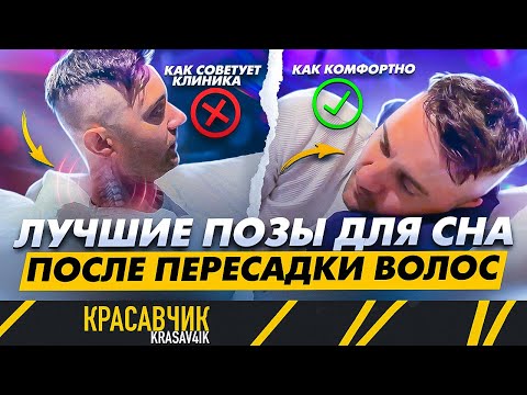 Видео: Как спать после пересадки волос, чтобы не навредить волосам? / Красавчик