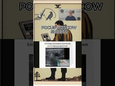 Видео: АКСИЛЛЯРНАЯ БЛОКАДА ПЛЕЧЕВОГО СПЛЕТЕНИЯ СЕРИЯ РЕГИОНАРНАЯ АНЕСТЕЗИЯ ЭКСПЕРТНОГО УРОВНЯ  POCUS MOSCOW