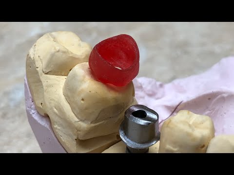Видео: Pattern Resin . Как пользоваться паттерн резин . Зубной техник. Моделировка каркаса под МК.