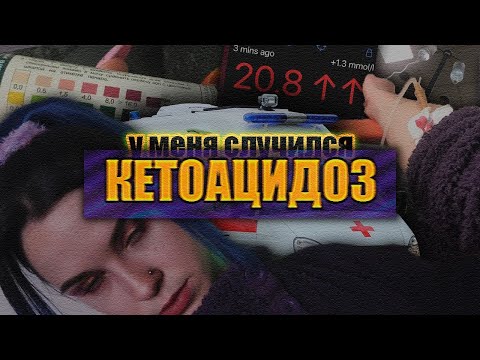 Видео: КЕТОАЦИДОЗ | ЧТО ВАС ЖДЁТ И ПОЧЕМУ СТРАШНО НАДЕЯТЬСЯ НА СКОРУЮ ПОМОЩЬ И ВРАЧЕЙ В БОЛЬНИЦЕ | Диабет 1