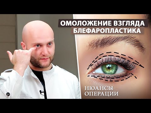 Видео: Для чего нужна блефаропластика? (пластика верхних и нижних век)