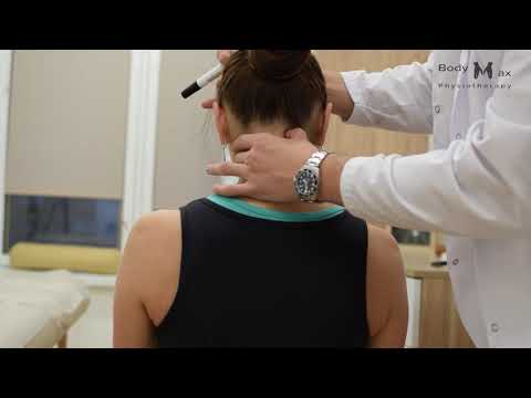 Видео: Шаткость. Боль в затылке. Синдром ПОЗВОНОЧНОЙ артерии