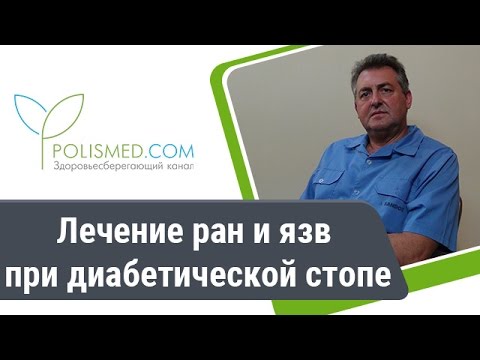 Видео: Лечение ран и язв при диабетической стопе: антисептики, коллаген, народная медицина