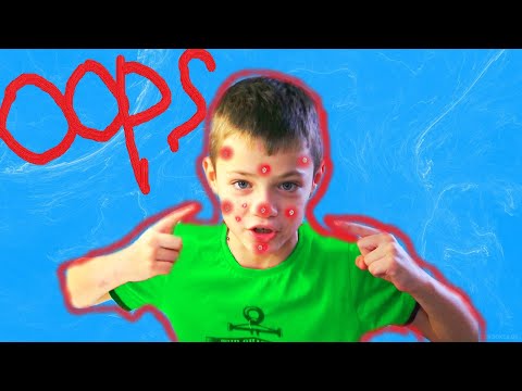 Видео: ПРЫЩИИИ????  МОЖЕТ ЭТО ЗАРАЗНО????