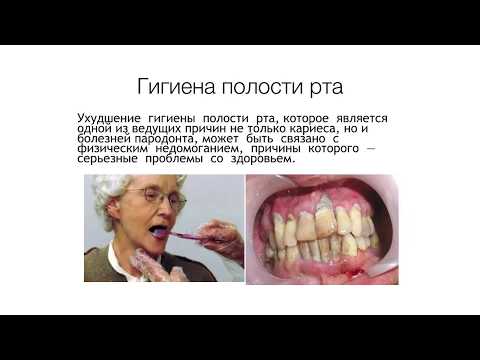Видео: Болезни зубов и пародонта у пожилых. Практическое занятие.
