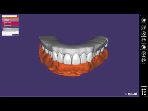 Видео: Работа с фотографией в Exocad