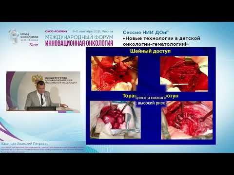 Видео: Торакоабдоминальная хирургия в детской онкологии.
