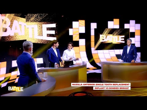 Видео: Баттл. Одиночный отсутствующий зуб на верхней челюсти. Имплантат или адгезивный мост.