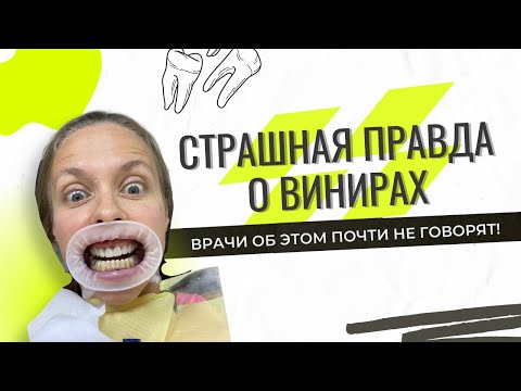 Видео: ВСЯ ПРАВДА О ВИНИРАХ - О ЧЕМ МОЛЧАТ СТОМАТОЛОГИ?